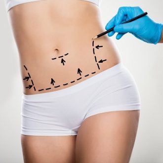 Mini Abdominoplasty Cost In Dubai & Abu Dhabi