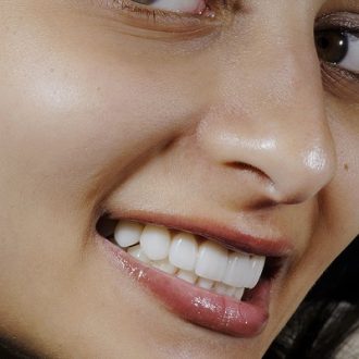 What are the Side Effects of Hollywood Smile?