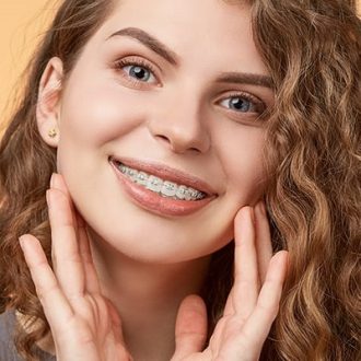 What are the Benefits of Ceramic Braces in Dubai?
