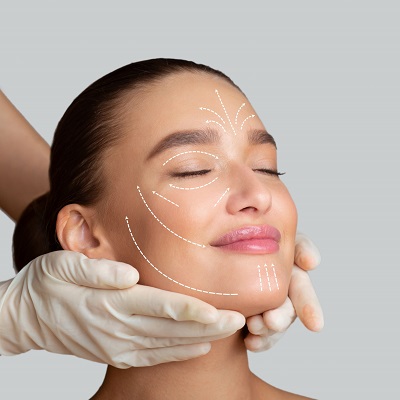 Cosmelan Peel The Solution for Unwanted Pigmentation in Dubai