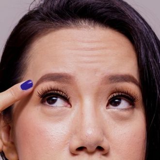 Fine Lines and Wrinkles on the Forehead in Dubai