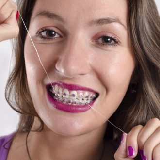 How Dental Braces Work in Dubai & Abu Dhabi