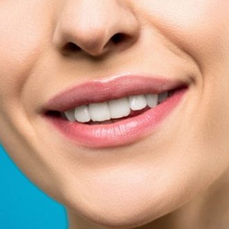 How To Get Rid Of Yellow Teeth in Dubai