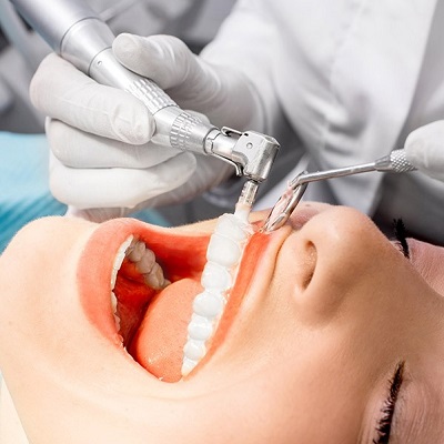 How To Remove Stains From Teeth in Dubai