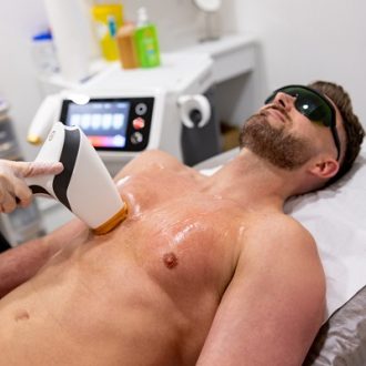 Laser Hair Removal For Men in Dubai