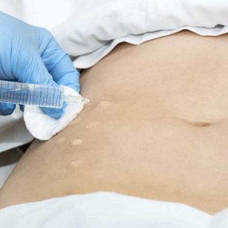 Laser Lipolysis Treatment: The Future of the Body Contouring