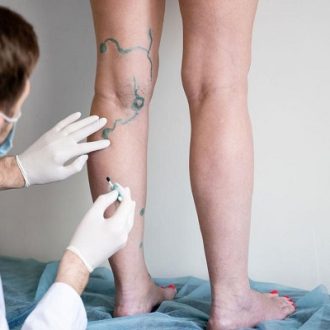 What are the Types of Vascular Surgery in Dubai