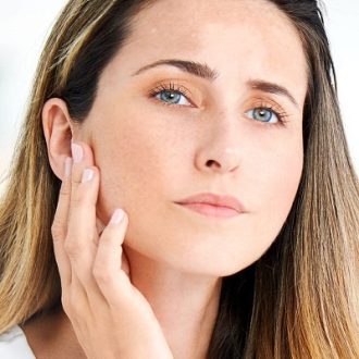 Will Melasma Go Away On Its Own