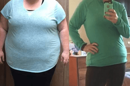 Best How Long Does Gastric Plication Last in Dubai