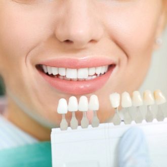 Does Teeth Whitening Work Permanently in Dubai?