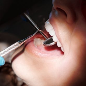 How Long Does a Single Root Canal Take in Dubai?