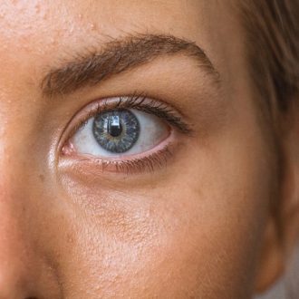 Is Laser Treatment Good For Pores in Dubai?