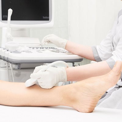 Varicose Veins Treatment: Myths And Facts
