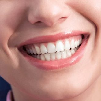 Which Type of Smile is the Best in Dubai?