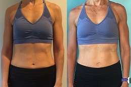 Who is The Best Nutritionist in Dubai