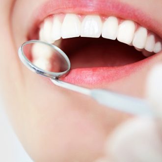 Are There Any Maintenance Tips for Teeth Whitening