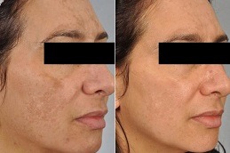 Best Why Are Cosmetologists Important in Dubai