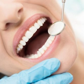 Do Teeth Look Better After Cleaning in Dubai?