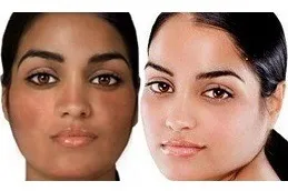 is glutathione allowed in dubai Best For Skin Whitening Cobal B12 Injection 1mg/1ml
