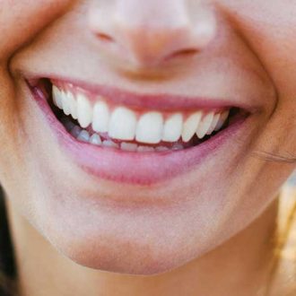 How Are People Getting Their Teeth So White?