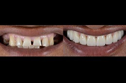 How to Treat a Toothache Clinic in Abu Dhabi
