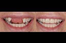 How to Treat a Toothache in Dubai