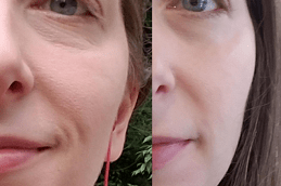 Hyaluronic Acid Serum For Skin in Dubai