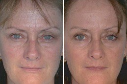 What Does Red Led Light Do For The Skin Clinic in Abu Dhabi