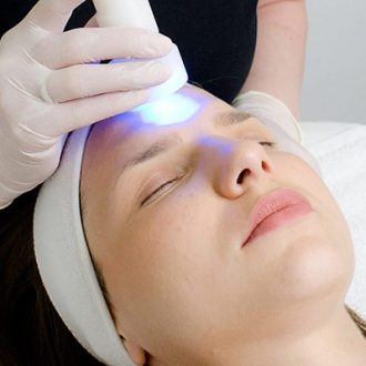 Are Lasers Safe To Use For Melasma in Dubai?