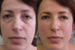 Best Types Of Stem Cell Therapy - An Overview in Dubai