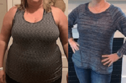 Best Weight Gain After Bariatric Surgery Facts And Solutions Clinic in Dubai & Abu Dhabi