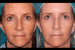 Best What Diseases Can Be Treated With Regenerative Medicine in Dubai
