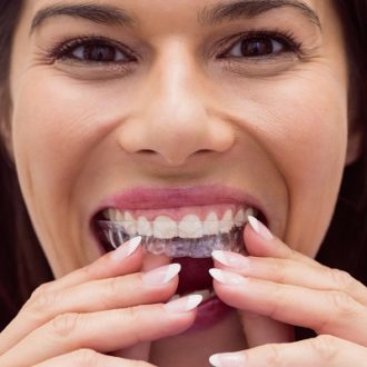 Can Aligners Change Face Shape in Dubai?