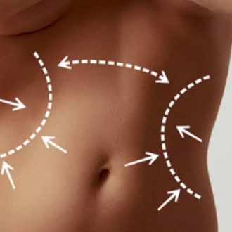 Can Laser Lipo Damage Your Organs in Dubai
