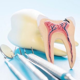 Can Root Canals Grow Back in Dubai & Abu Dhabi?