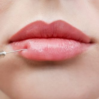 Classic Lips Vs Russian Lips in Dubai & Abu Dhabi