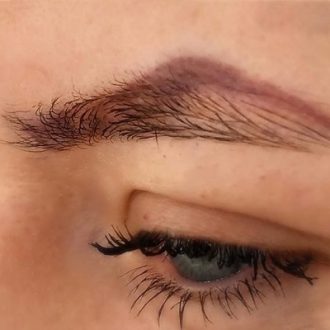 Eyebrow Tattoo Removal Price In Dubai