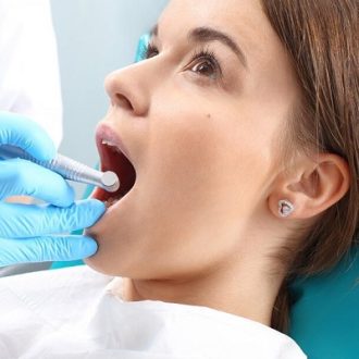 How Long Do Teeth Survive After A Root Canal in Dubai?