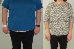 Weight Gain After Bariatric Surgery Facts And Solutions Clinic in Abu Dhabi
