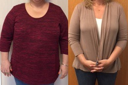 Weight Gain After Bariatric Surgery Facts And Solutions Clinic in Dubai & Abu Dhabi