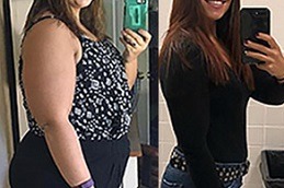 Weight Gain After Bariatric Surgery Facts And Solutions in Dubai