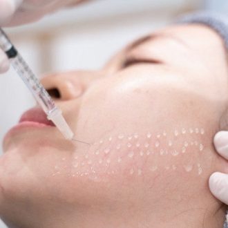 What Is Better: Mesotherapy Or Bio Revitalization?