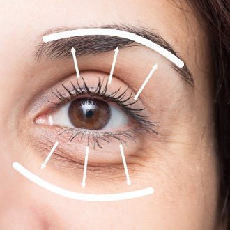 What To Expect During Eyelid Surgery In Dubai