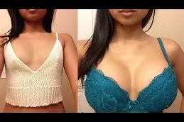 AFT Breast Augmentation Clinic in Dubai