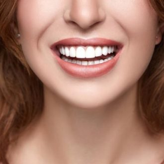 Are Veneers Stronger Than Teeth in Dubai?