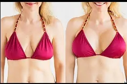 Best Breast Surgery Clinic in Dubai & Abu Dhabi