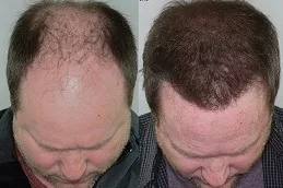 Best G Cell Treatment Clinic in Dubai & Abu Dhabi