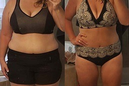 Best Is Gastric Bypass A Permanent Weight Loss Procedure Clinic in Dubai & Abu Dhabi