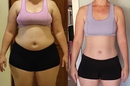 Best Is Gastric Bypass A Permanent Weight Loss Procedure Clinic in Dubai