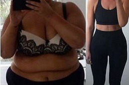 Best Is Weight Loss With The Mini Gastric Bypass Safe in Dubai